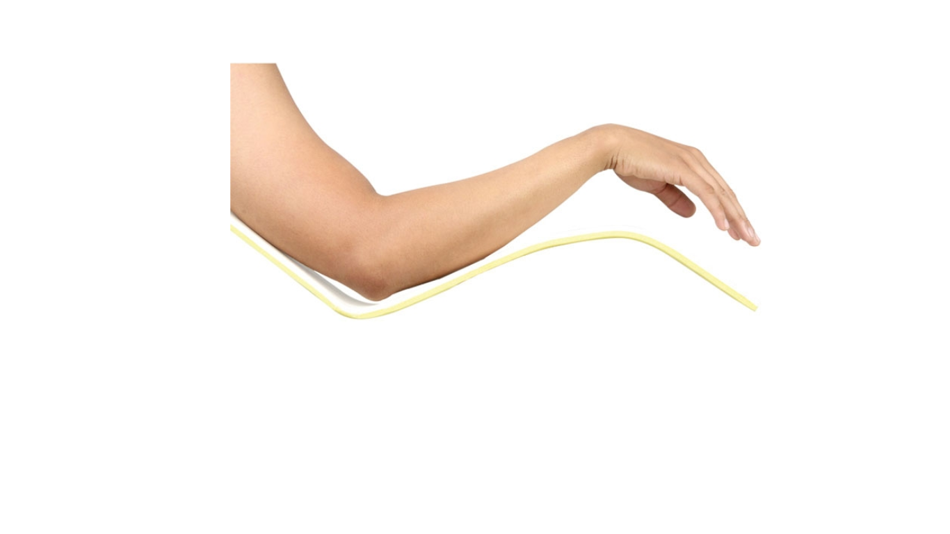 Long Arim "U" Splint